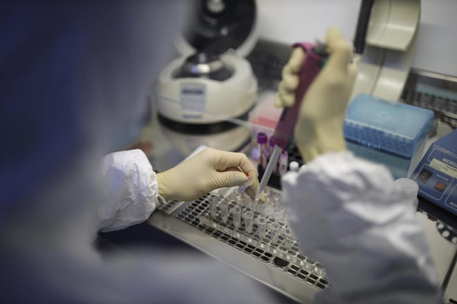 A medical staffer works with test systems for the diagnosis of coronavirus, at the Krasnodar Center for Hygiene and Epidemiology microbiology lab in Krasnodar, Russia, Tuesday, Feb. 4, 2020. (AP Photo)