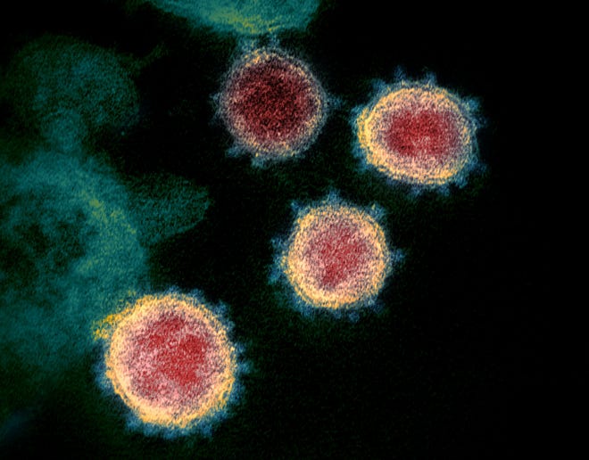 This undated electron microscope image made available by the U.S. National Institutes of Health in February 2020 shows the virus that causes COVID-19. The sample was isolated from a patient in the U.S. [NIAID-RML via AP]