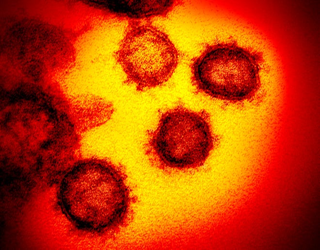 Novel Coronavirus SARS-CoV-2 This transmission electron microscope image shows SARS-CoV-2—also known as 2019-nCoV, the virus that causes COVID-19. isolated from a patient in the U.S., emerging from the surface of cells cultured in the lab. Credit: NIAID-RML