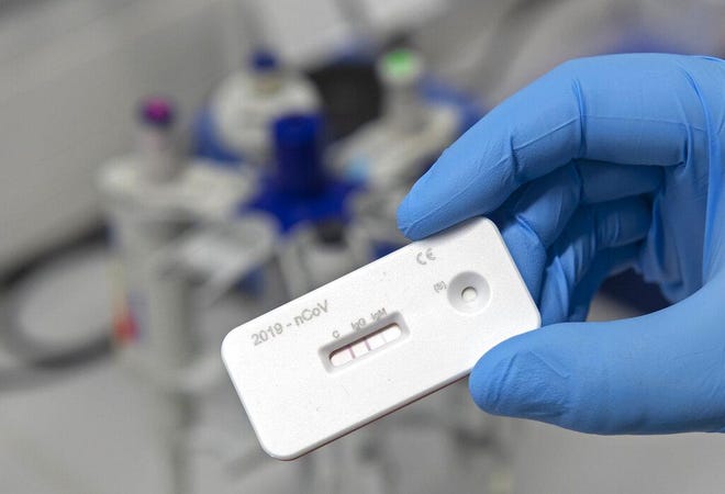 A scientist presents an antibody test for coronavirus. [Jens Meyer/ASSOCIATED PRESS]