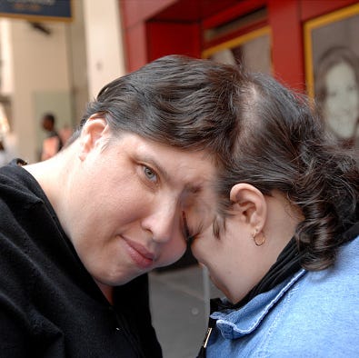 Lori and George Schappell, the world's oldest female conjoined twins, attend the opening celebration of the new Ripley's Believe It or Not Odditorium in Times Square.