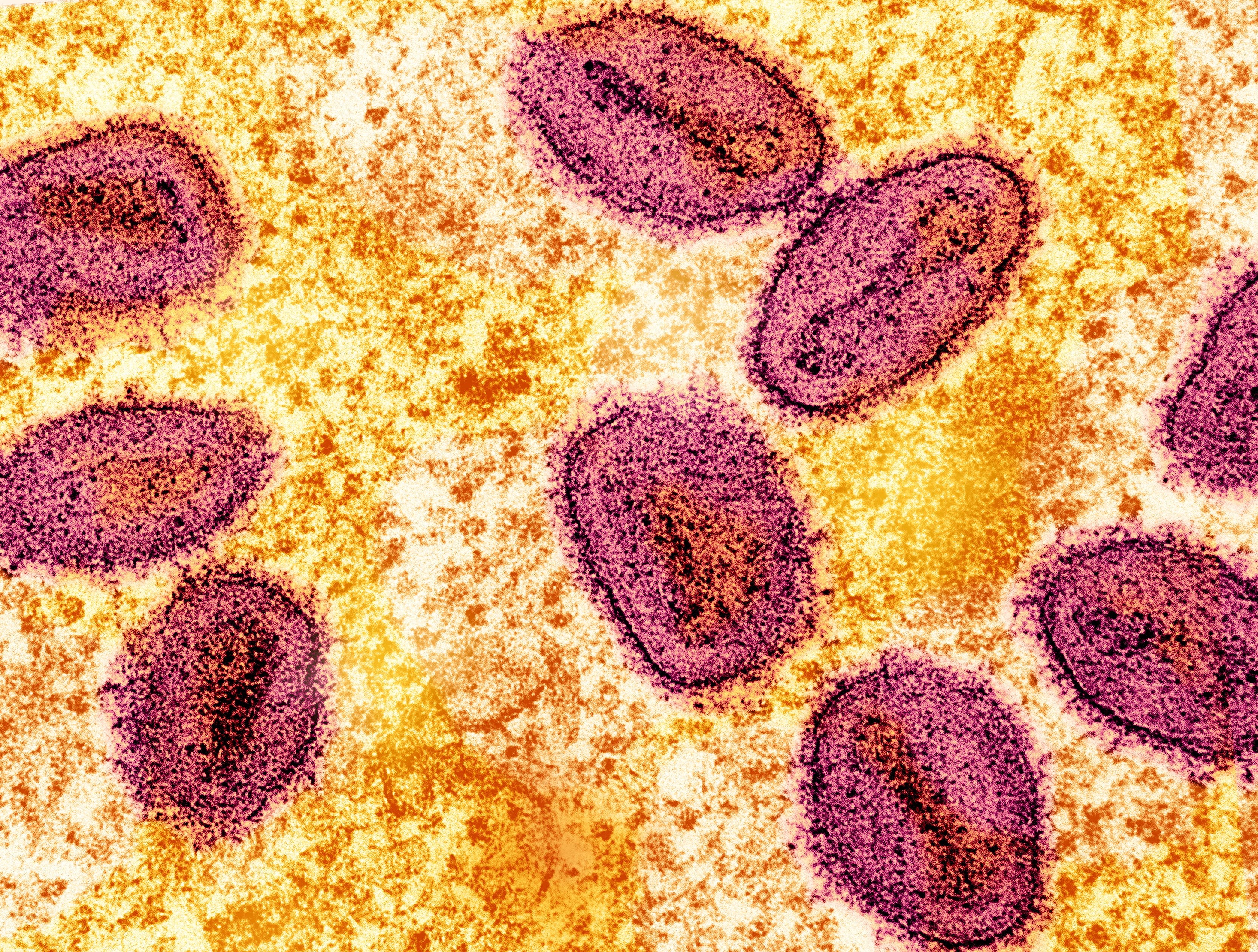 An undated colorized transmission electron micrograph of mpox virus particles (pink) found within an infected cell (yellow), cultured in the laboratory, captured at the National Institute of Allergy and Infectious Diseases (NIAID) Integrated Research Facility (IRF) in Fort Detrick, Maryland.