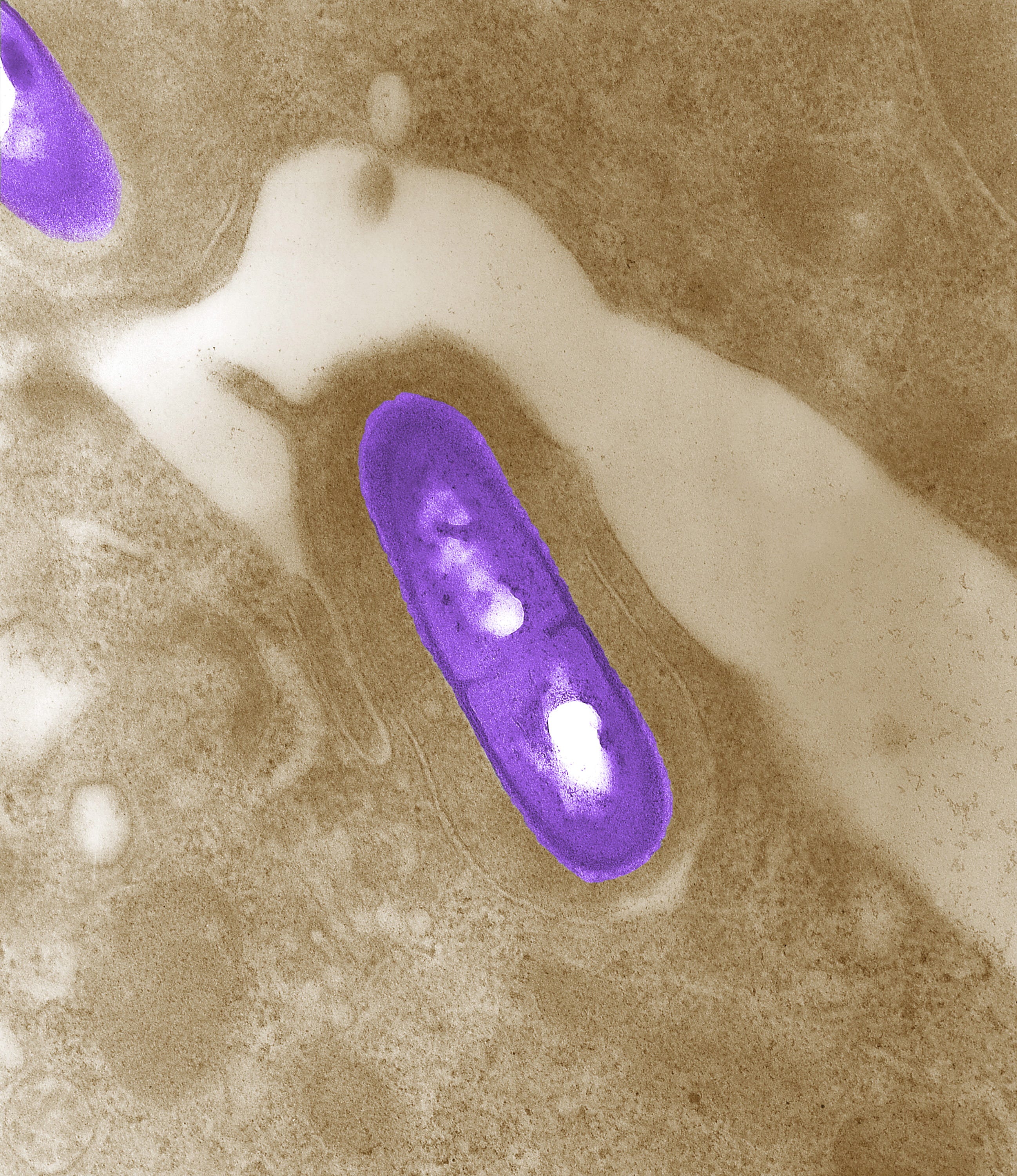 Listeria outbreak in CA, NV leads to recall of prepared foods