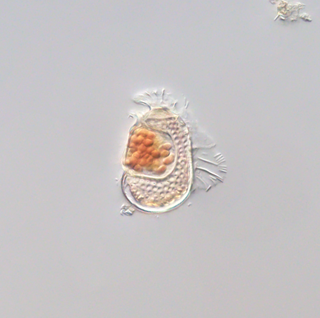 Hidden inside this dinoflagellate (Citharistes regius) is a tiny microbe so reliant on its host that scientists say it's the most viruslike cellular organism known, according to Science magazine.