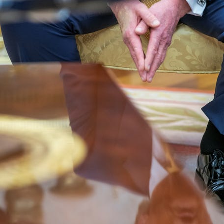 Swollen ankle of U.S. President Donald Trump as he meets with Bahrain's Crown Prince and Prime Minister Salman bin Hamad Al Khalifa (not pictured), in the Oval Office at the White House in Washington, D.C., U.S., July 16, 2025. In a July 17, 2025 press briefing, U.S. Press Secretary Karoline Leavitt read a statement from his doctor that President Trump has a chronic venous insufficiency".