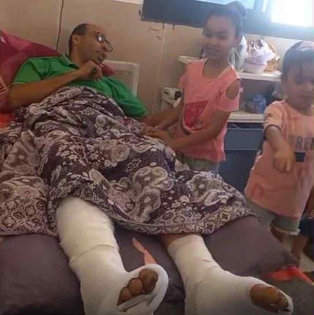 Mohamed Hammoudeh, a nutritionist and father of three sheltering in Gaza City, recovers from injuries he sustained while trying to secure food for his family.