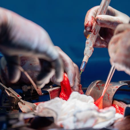 Surgeon is the highest-paying job suited to the ISTJ Myers-Briggs personality type, according to a new report.