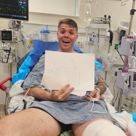 Chance Armand, of Milton, Florida, was bit by a Bull shark spearfishing off Pensacola Pass on Aug. 2, 2025.