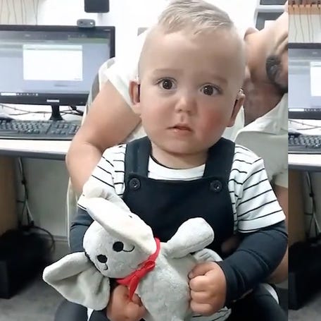 18-month-old finally hears mom's voice with hearing aids