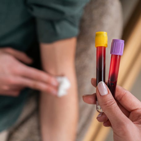 Is the Galleri blood test the future of cancer treatment? It's not that simple. The new research from the company, while promising, isn't some cure-all.