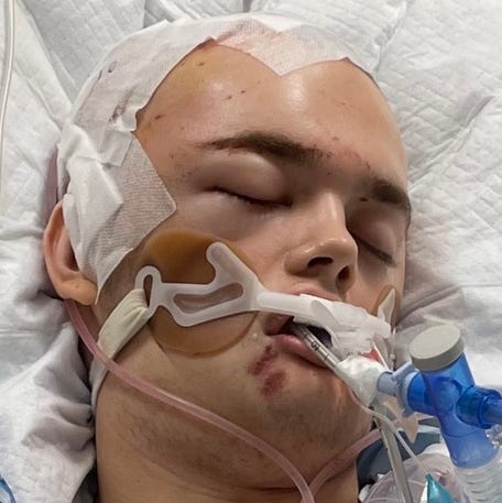 Luke Resecker is pictured in the hospital after suffering a head injury in a fatal crash in Texas that happened when he crossed the center line in a no-passing zone and collided head-on with a minivan carrying seven members of a family.