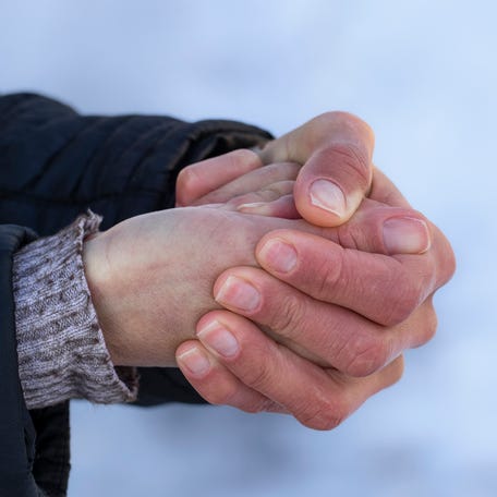 Here's what hypothermia is, what causes it and how it is typically treated if it affects you or someone you love.