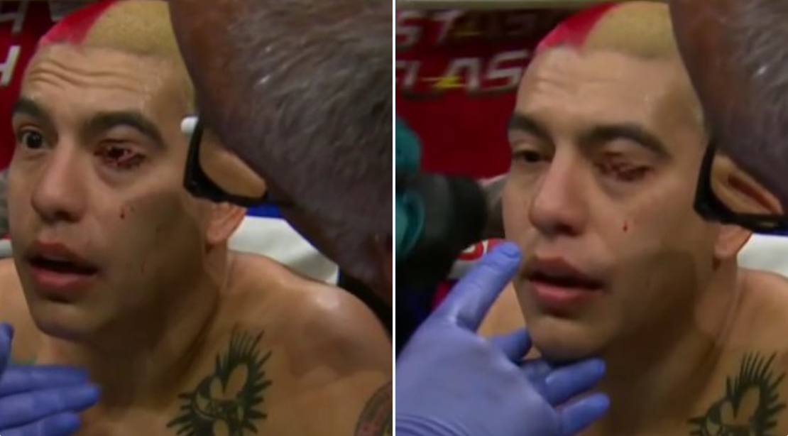 BKFC fighter suffers shredded eyelid thanks to 'TUF' alum