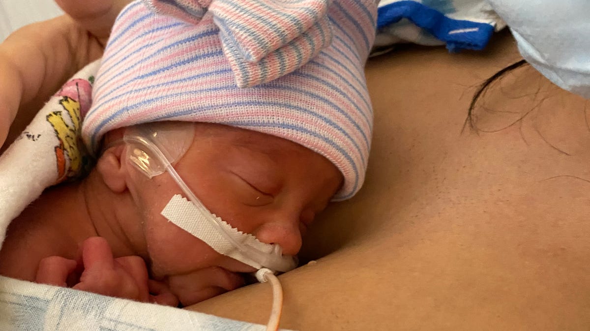 A new mom's daughter was rushed to the NICU after the mother's emergency cesarean section. The baby came home at 5.5 pounds, with an oxygen tank.