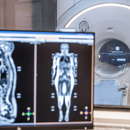 Research shows these full-body tests often find something, but much less often find actual disease.