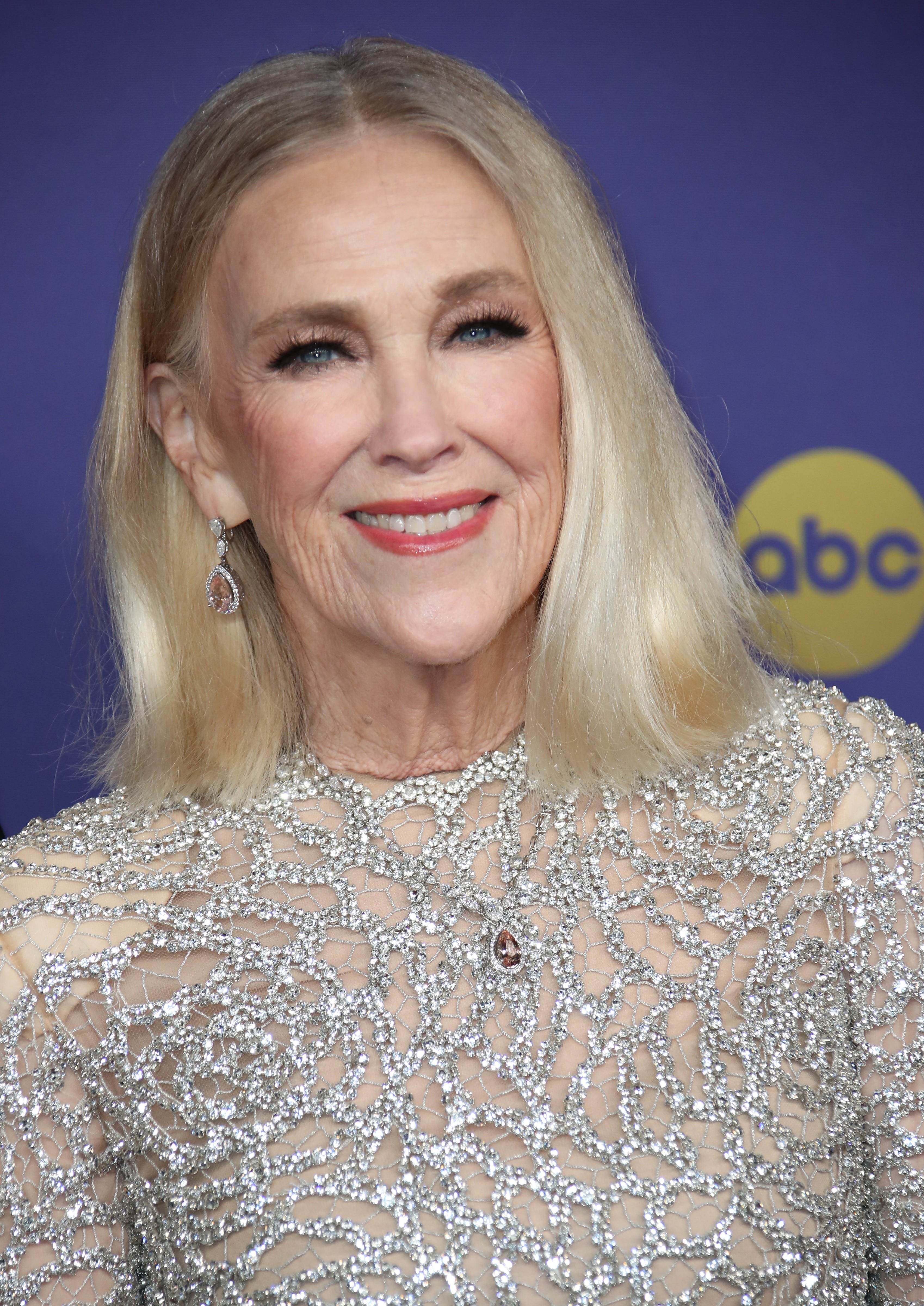 Catherine O’Hara died from a pulmonary embolism. What to know.