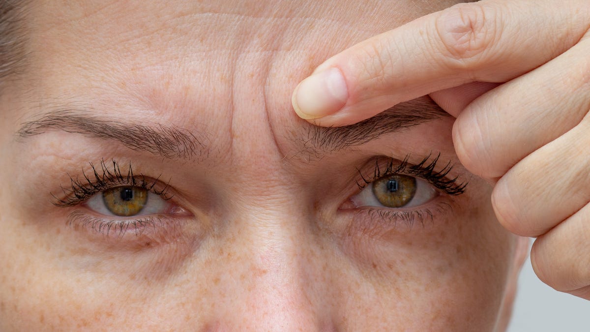 Collagen not a 'quick fix' for wrinkles but helps in other ways, study finds