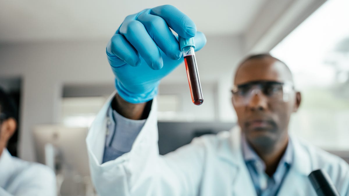 A major change could be coming in mental health diagnoses, psychiatrists say