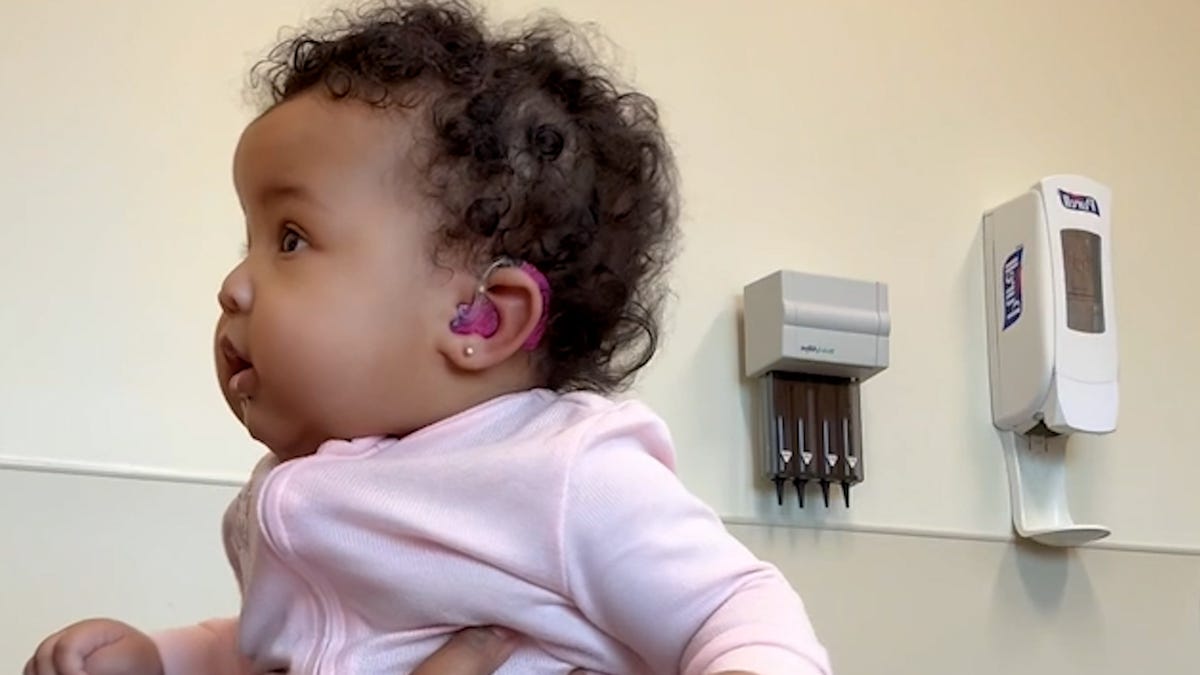 A four-month-old baby in Arizona beams with joy when her new hearing aids allow her to clearly hear her mom's voice for the first time.