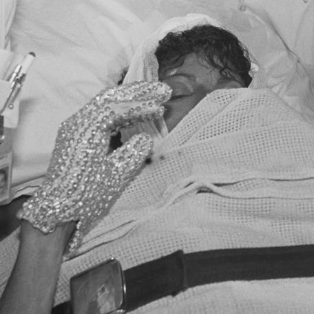 Paramedics wheel Michael Jackson into Brotman Memorial Hospital in Los Angeles after being burned during the filming of a Pepsi commercial. Exploding fireworks set his jacket and hair on fire giving him second degree burns on his scalp.