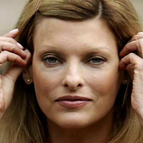 Linda Evangelista says she's 'permanently deformed