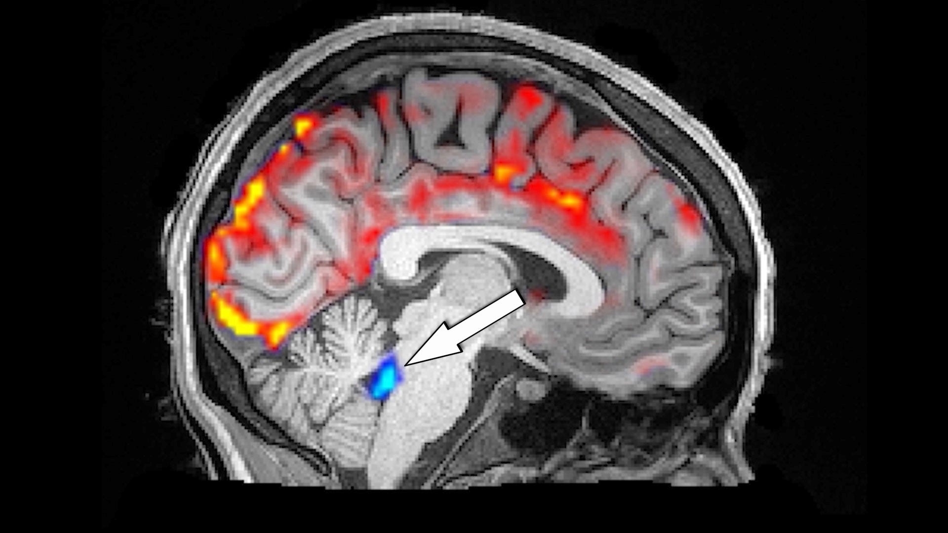 Watch what happens inside your brain during sleep
