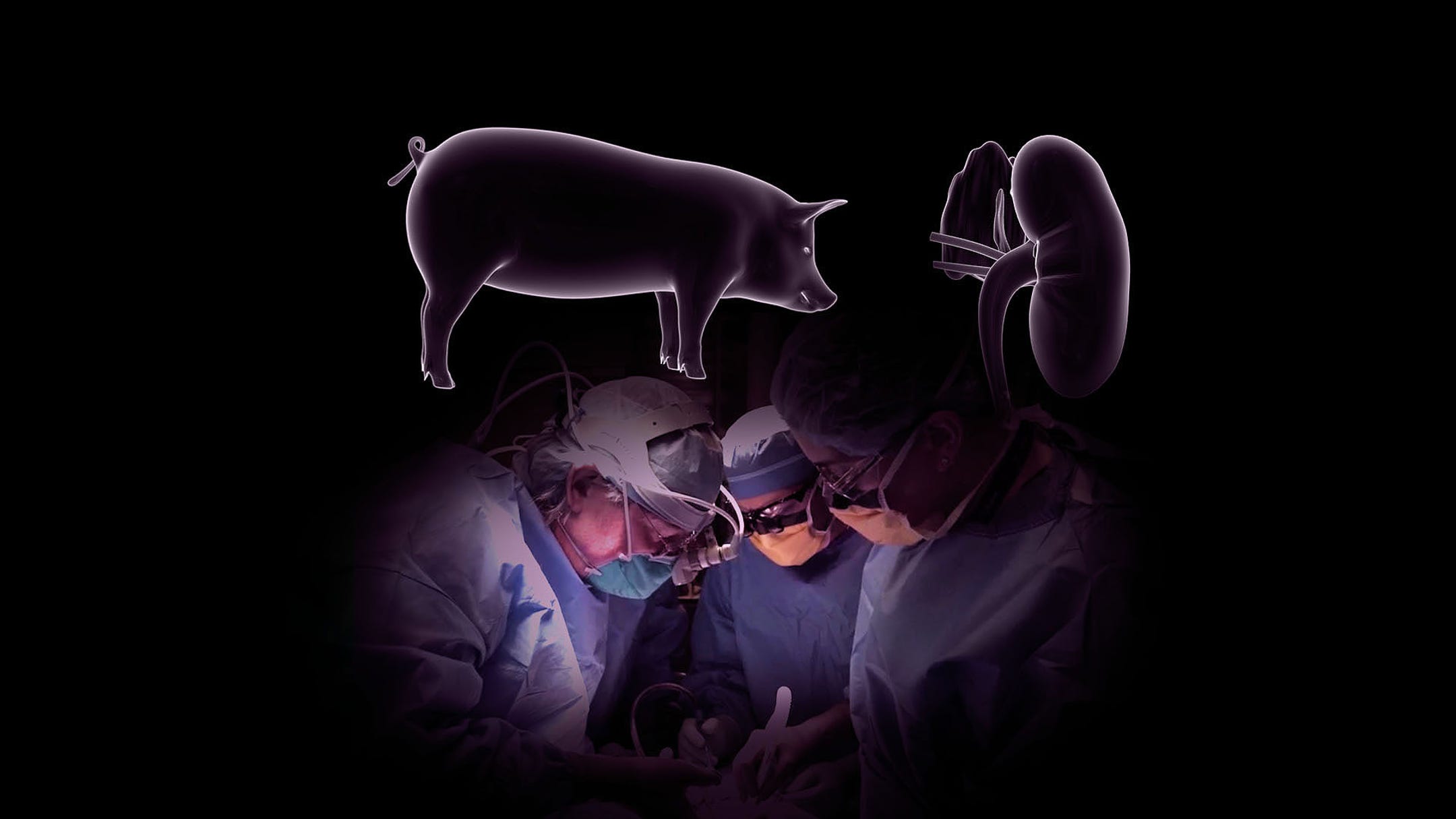 Organ transplants with pig kidneys? Groundbreaking step
