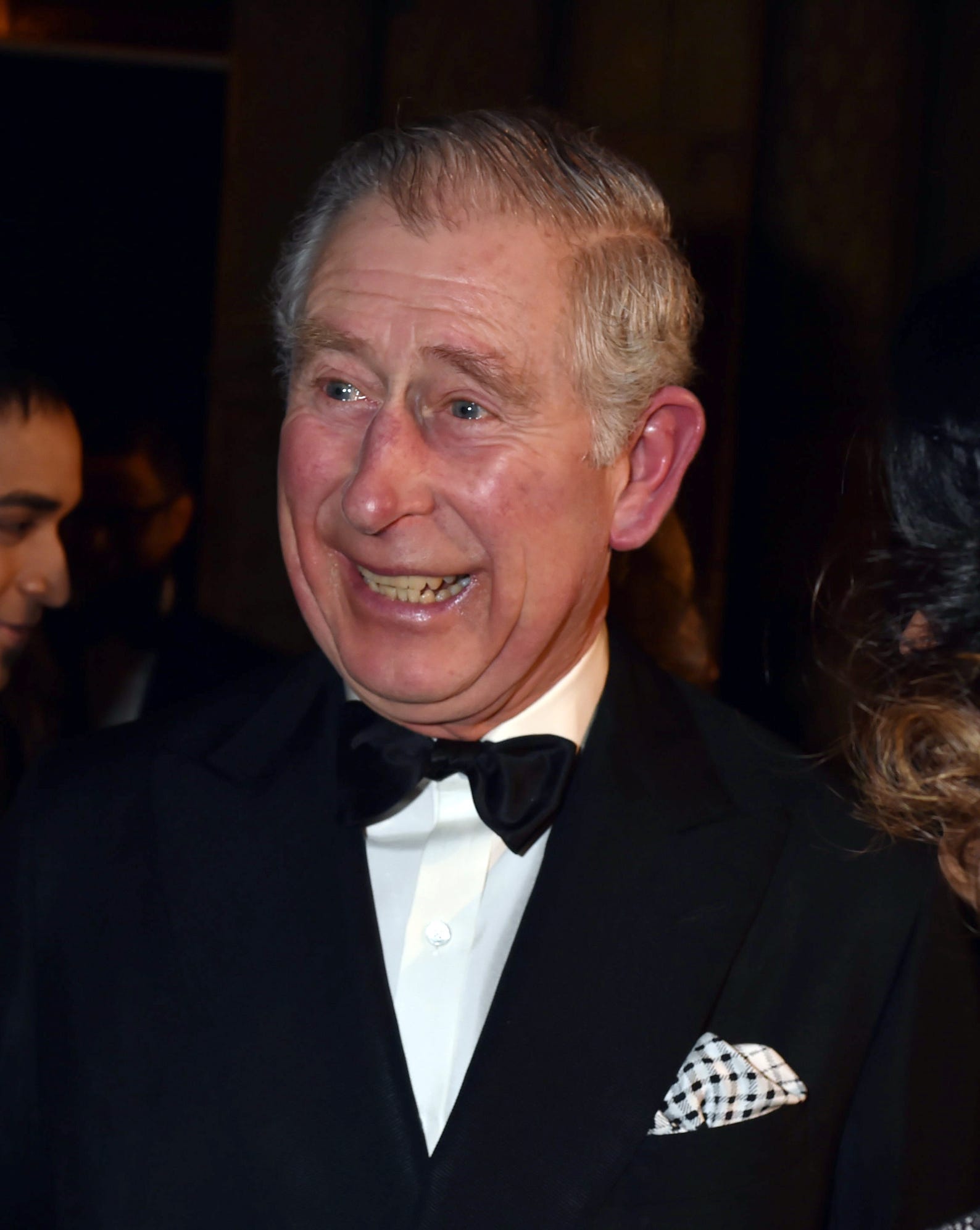 What Happened To Prince William S Hair