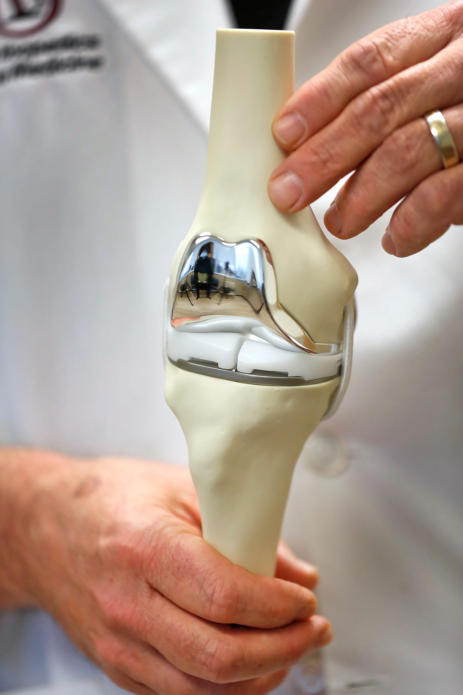 Replacement knees fresh off the 3-D printer