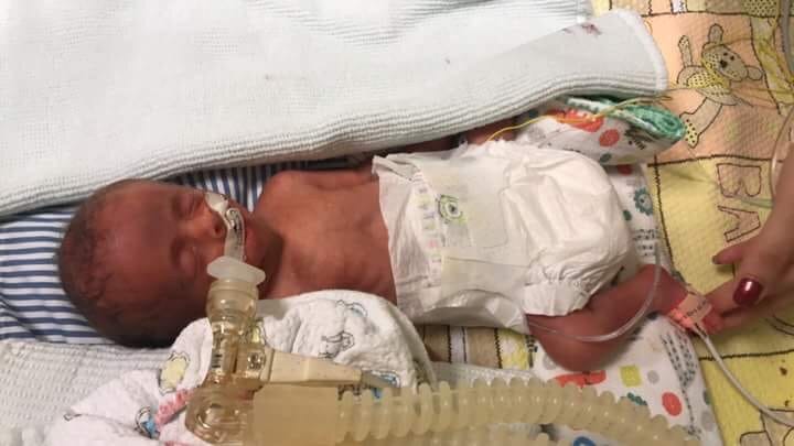 Premature baby held in Mexican hospital arrives at Riley Children's Hospital
