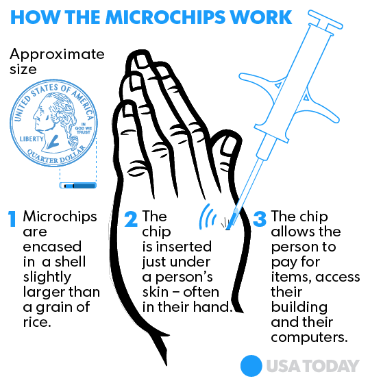 Are embedded microchips dangerous? Ask the Swedes — and pets