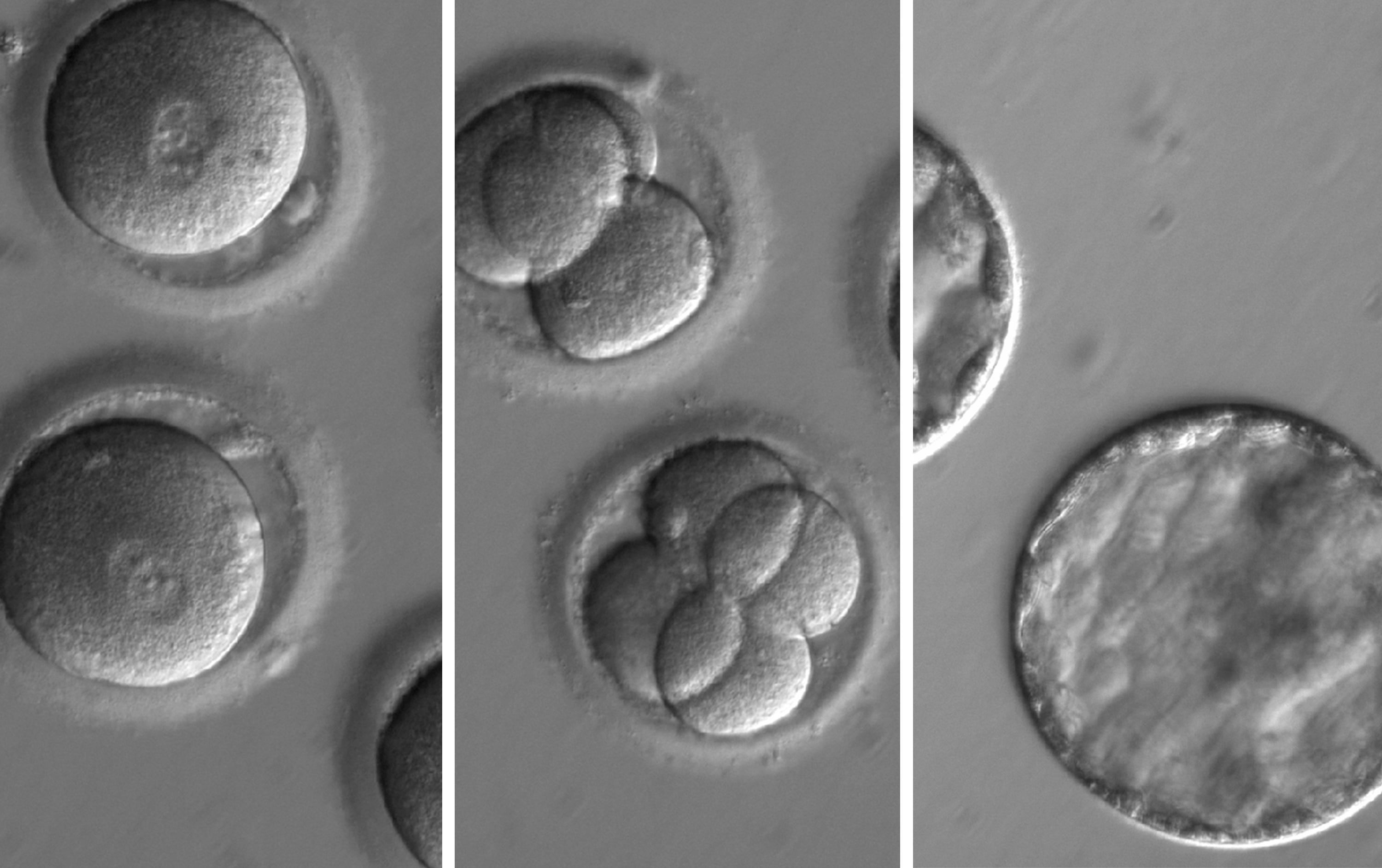 This sequence of images shows the development of embryos after correcting for a genetic error that would otherwise cause a type of inherited heart disease.