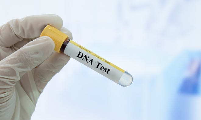 DNA test.