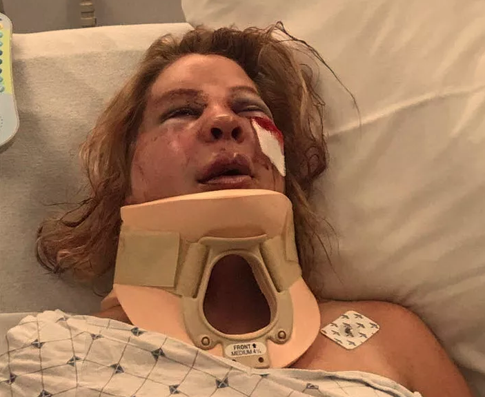 Pregnant woman fights off an attacker in East End