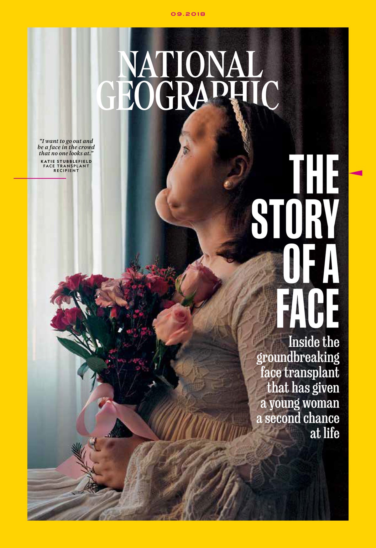 Youngest Face Transplant Recipient Shares Story In National
