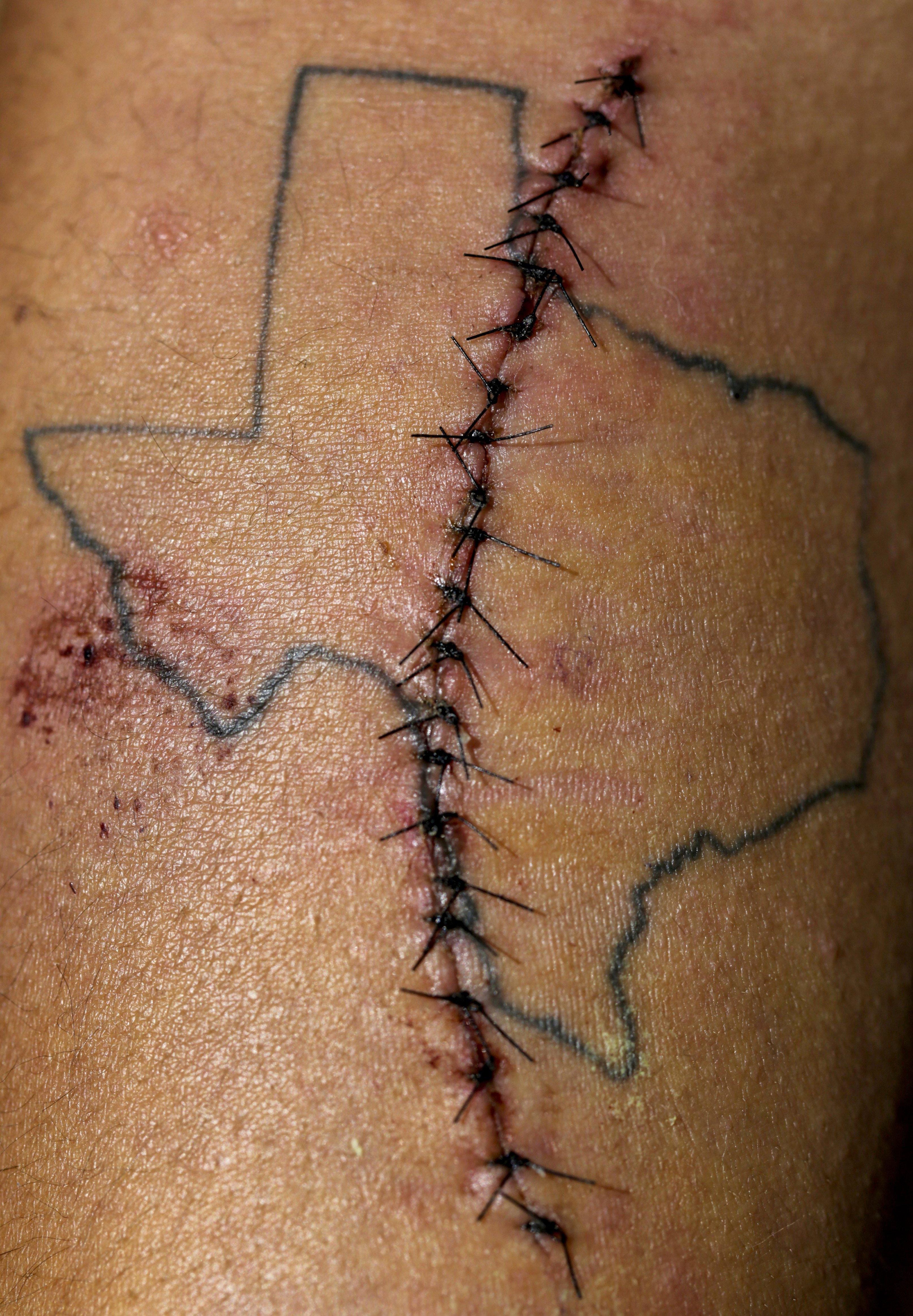 Stitches run through the center of Gemicah Jones' tattoo of Texas. Jones, 20, was attending a May 30 protest against police brutality with his friends when he was struck by a less-lethal projectile. He needed emergency surgery because it had entered near an artery in his forearm.