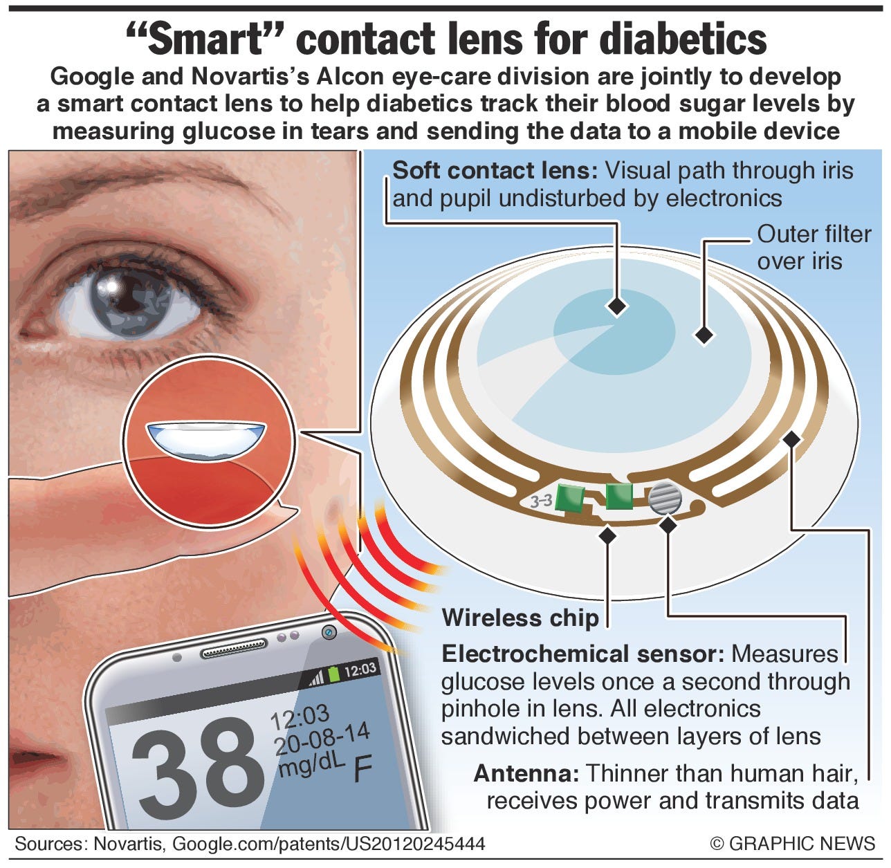 Grondwet meditatie Omtrek Infographic: Google developing a smart contact lens for diabetics