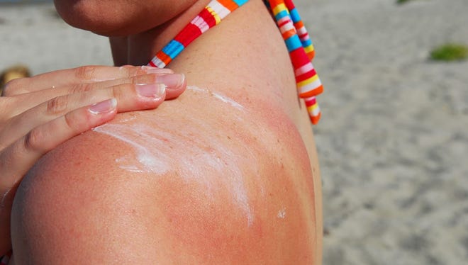 You can reverse sun damage on your skin--a dermatologist explains