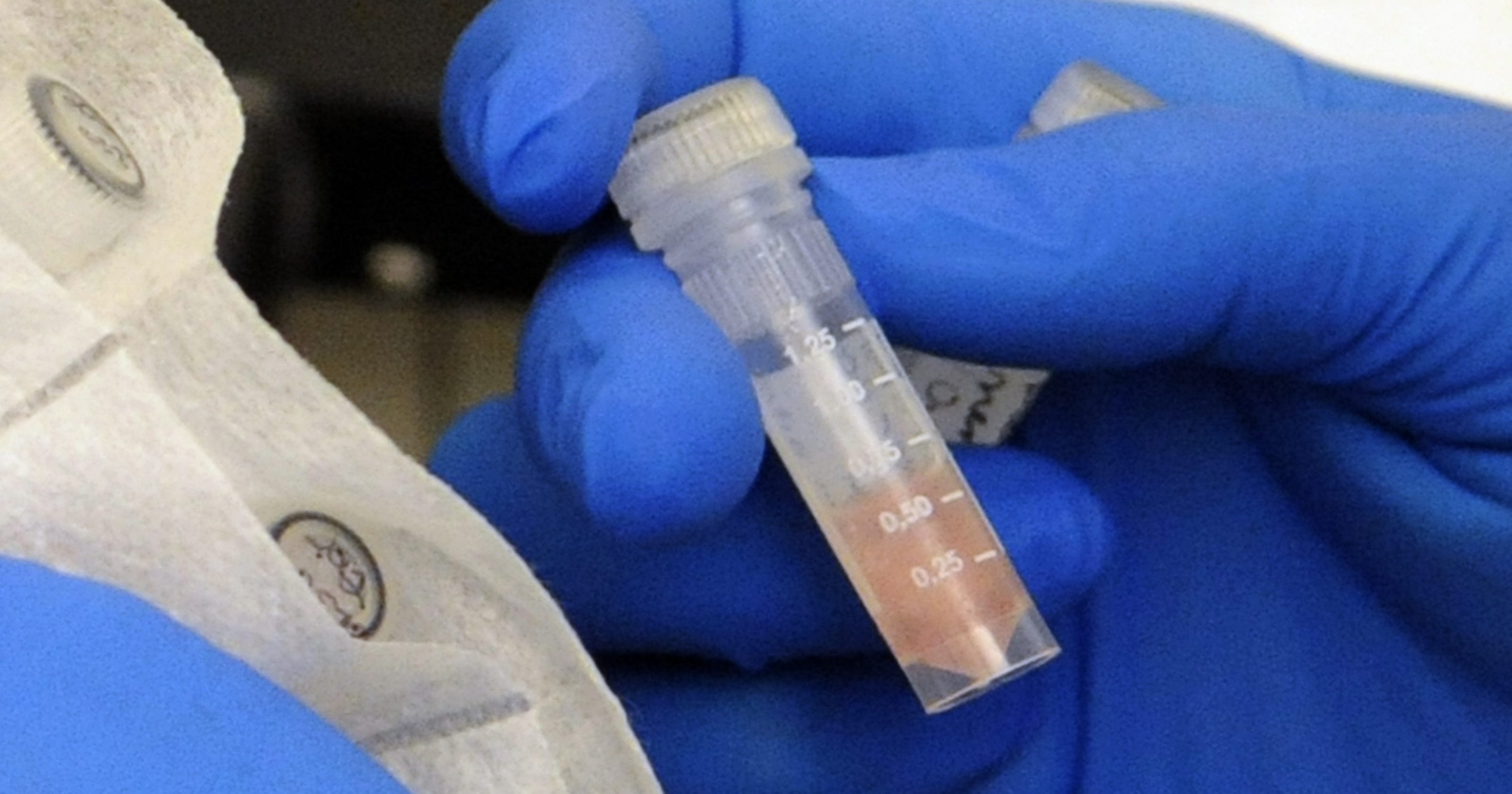 Older medicine spread meningitis