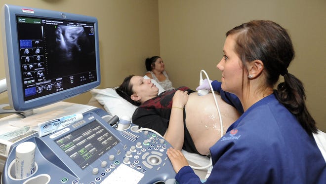 In July 2010 in Sioux Falls, S.D., Christie Sachtjen performed an ultrasound on Kari Dalseide, who was 33 weeks' pregnant.