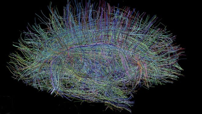 Neural fibers in brain image.