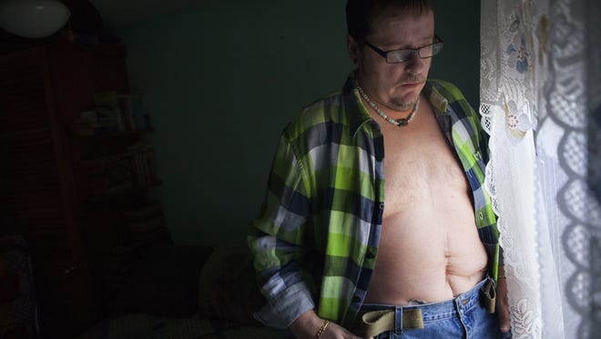 "I still get wicked pains in my stomach from the scar tissue, and the scars on the outside are so bad, I can't ever go swimming or go to the beach or anywhere I'd take my shirt off," he says. "I've always been a happy guy, but every day is a struggle now. Some days, I just can't let go of it."