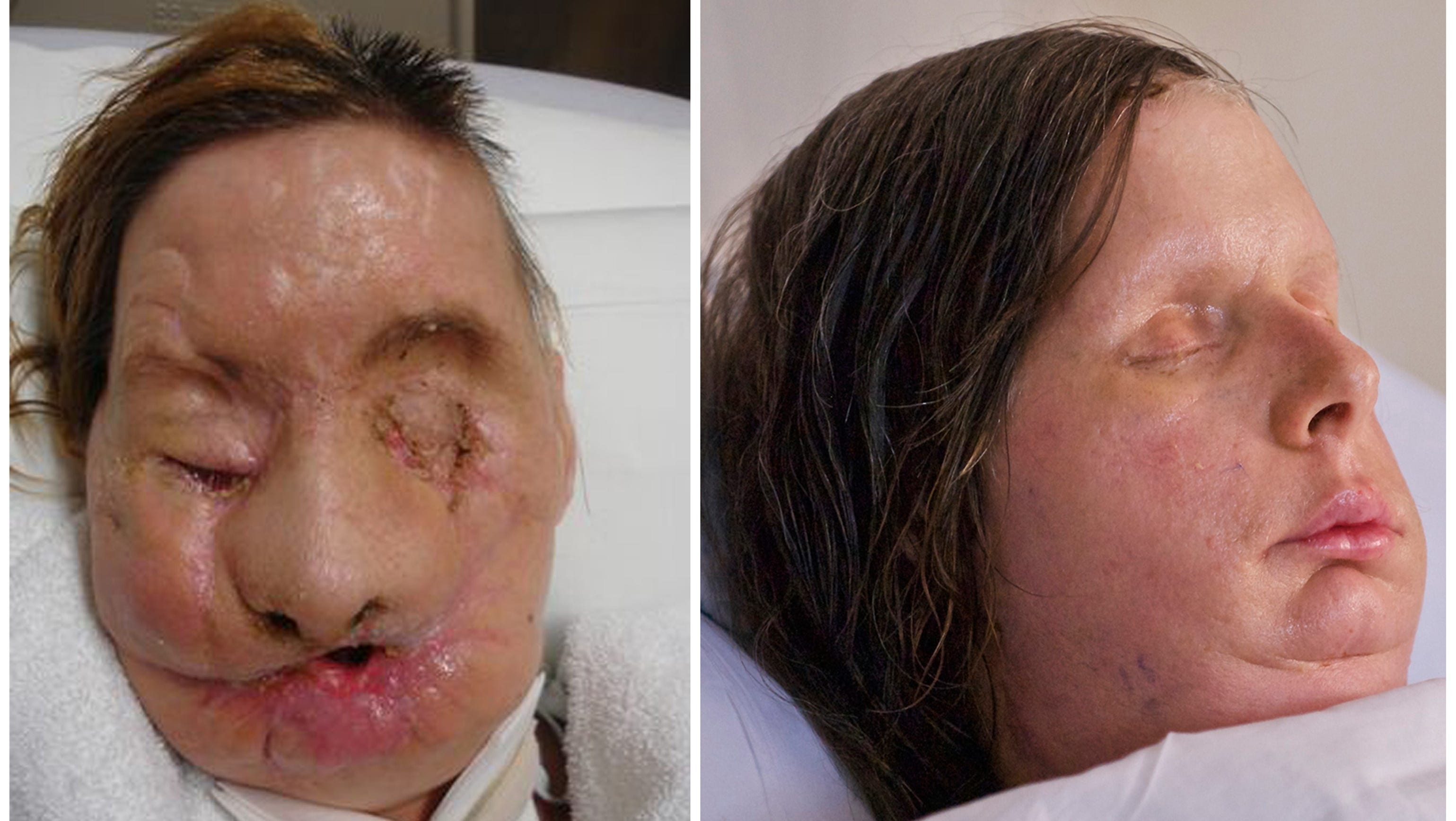 chimpanzee attack videos chimpanzee attack videos