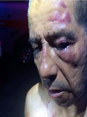 Richard Manriquez's court filing includes photos of his face covered in bruises and cuts, which he alleges is the result of an attack from police officers Aug. 20, 2016, in Superior, Arizona.
