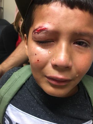Aiden Vasquez, 10, is in tears after what his mom calls a bullying incident at school on Monday, Aug. 27, 2018.