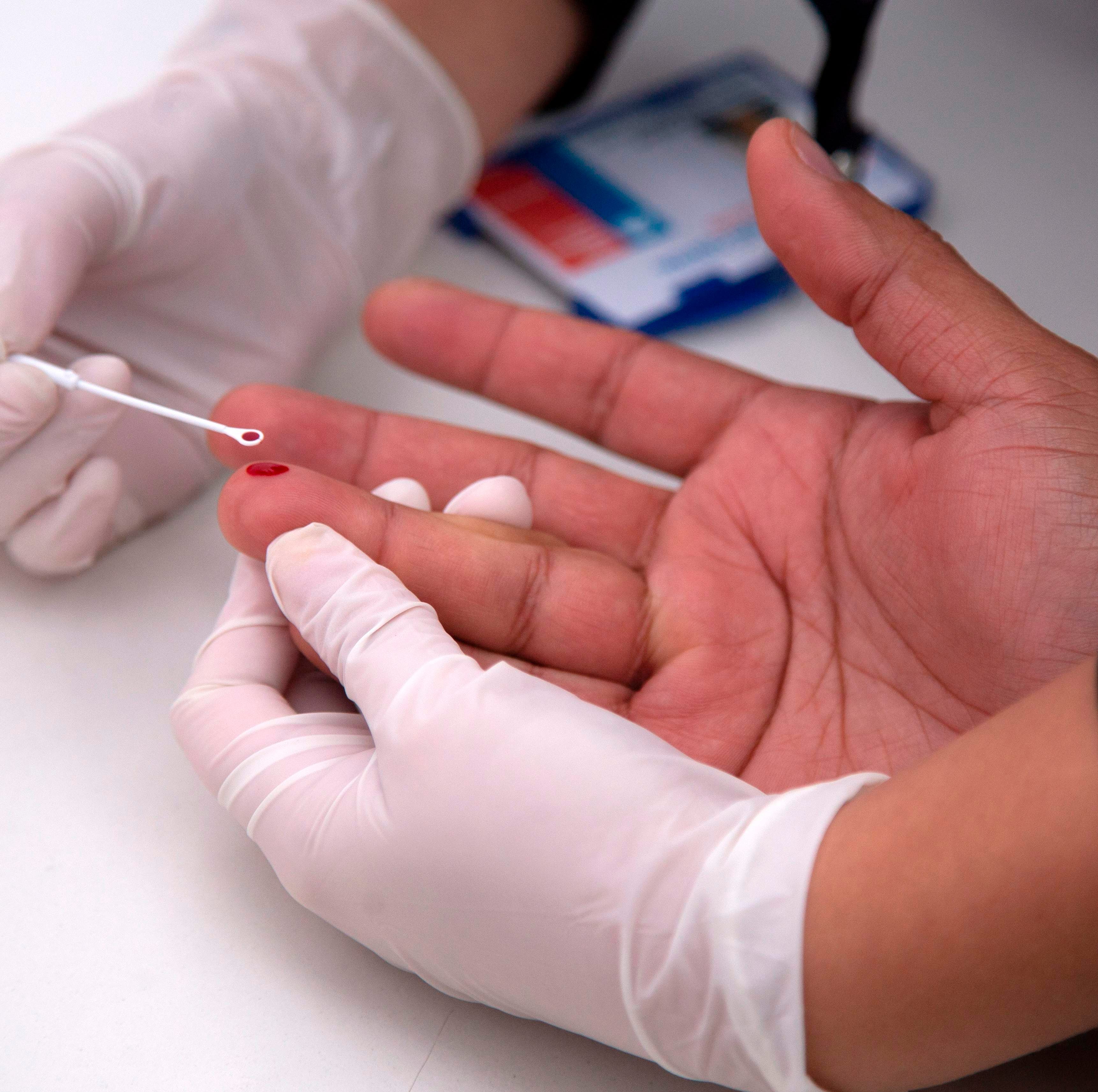 A man undergoes a rapid HIV test on June 23, 2018.