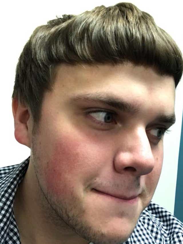 A Springfield Man Got A Bad Haircut His Photos Went Viral