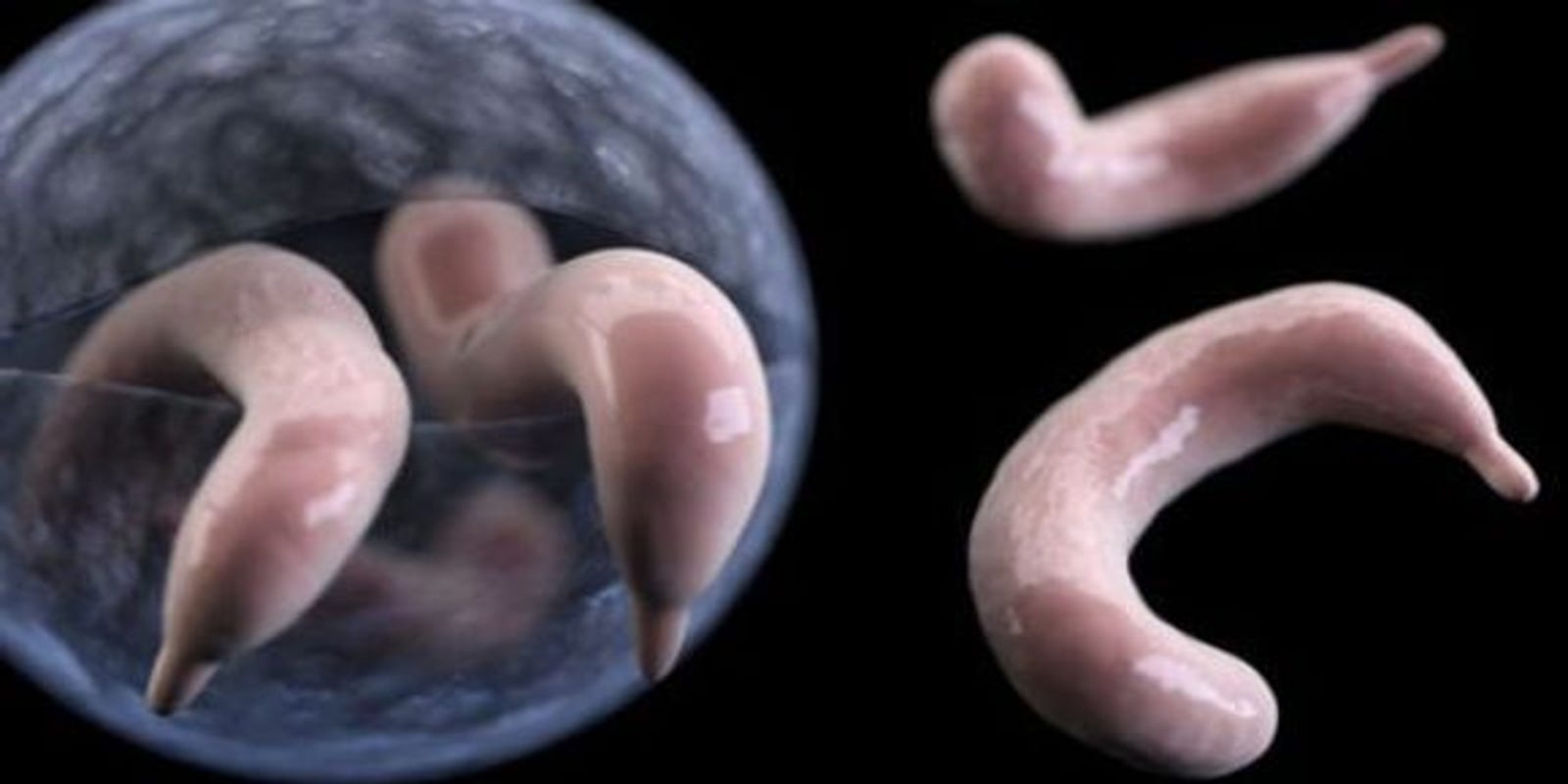 Are Parasites Contagious toxoplasmosis
