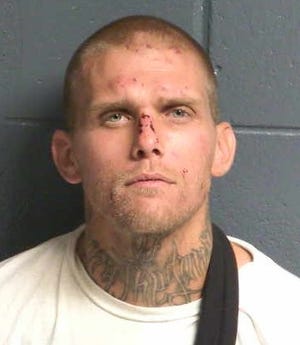 David Pedraza, a Doña Ana County man who claims he suffered injuries during an encounter with Las Cruces police officer Christopher Smelser in 2018. In this mugshot, following his arrest, Pedraza has cuts to his face and appears to be wearing a sling.