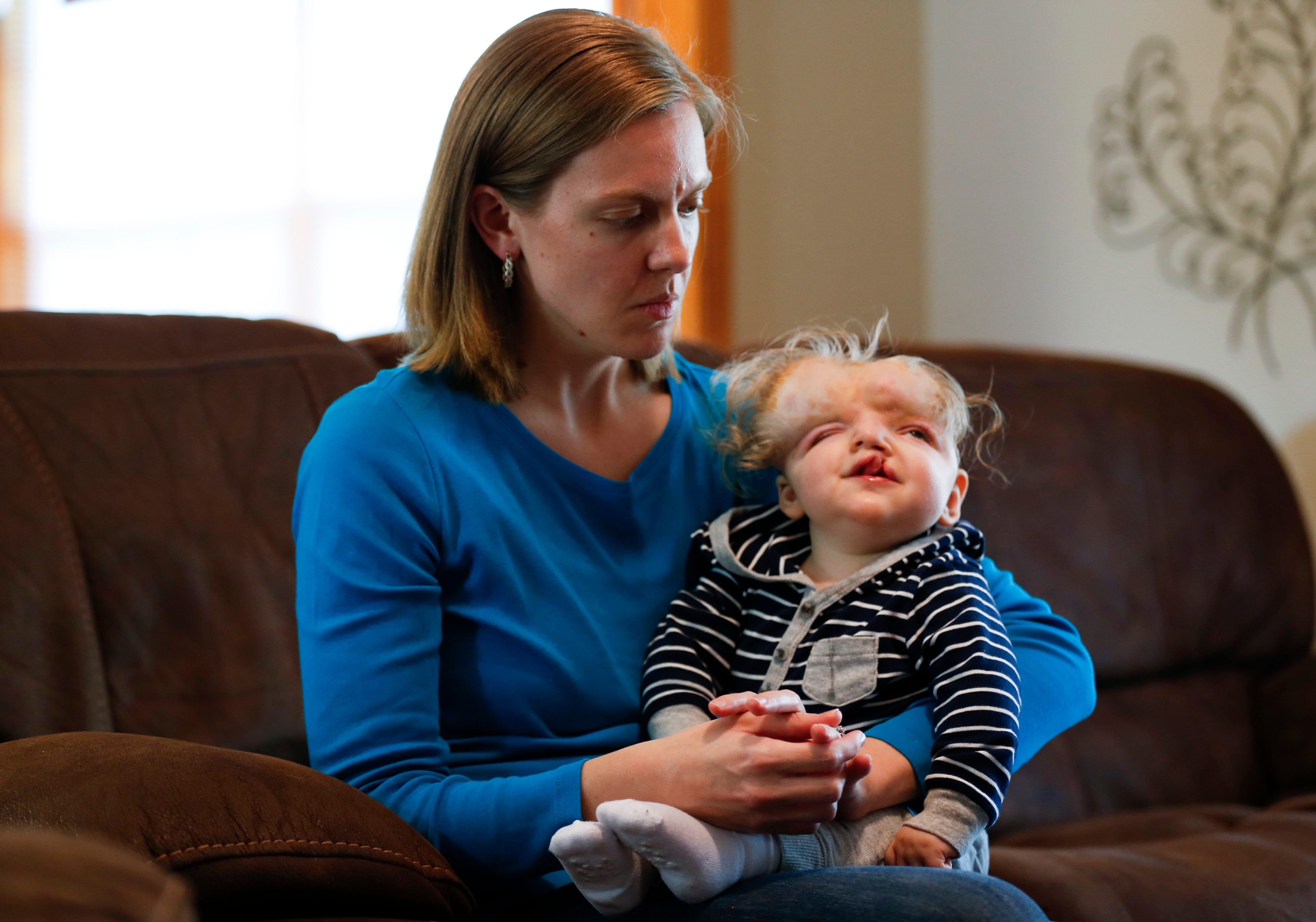 'I love him the way he is' — Springfield family shares joy of having